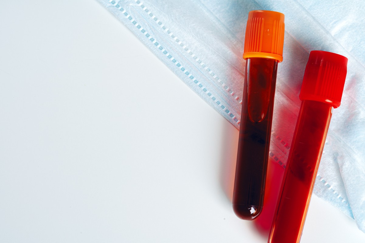 dwie fiolki z próbkami krwi